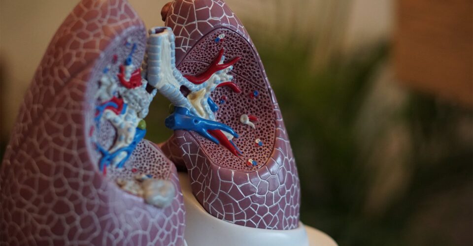 Keeping lungs alive outside the body