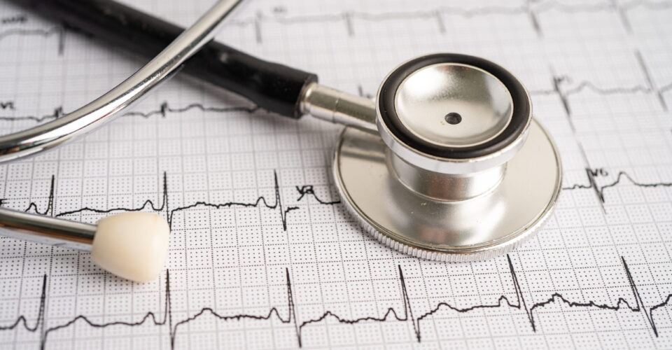 What are heart arrhythmias?